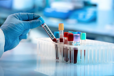 doctor hand taking a blood sample tube from a rack with machines of analysis in the lab background / Technician holding blood tube test in the research laboratory